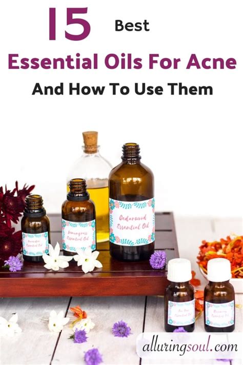 Best Essential Oils For Acne And Recipes