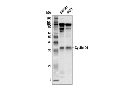 Cyclin D1 Antibody Cell Signaling Technology