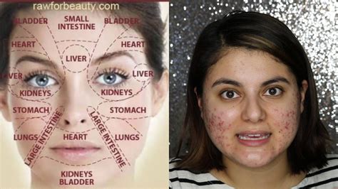 FACE MAPPING FOR ACNE Face Map With Me YouTube