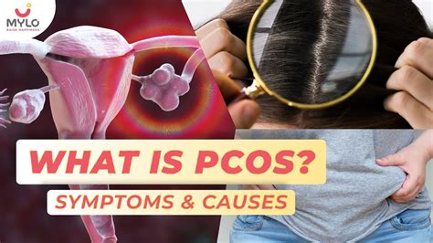 What Is PCOS What Are The Symptoms Of PCOS All About PCOS PCOD