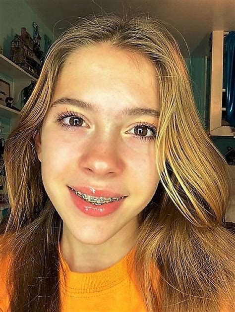 Pin By Iván Bassotti On Brakets Cute Braces Braces Girls Blonde