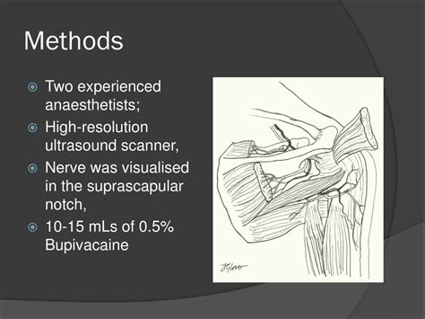 PPT - Ultrasound-Guided Suprascapular Nerve Block for Patients with ...