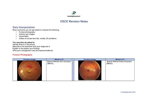 Osce Notes Insta Optom Data Interpretation Most Commonly You Can Get Asked To Interpret The