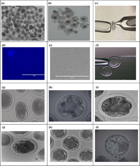 A Immature Oocyte B Mature Oocyte C Oocyte With FPB After 24 H