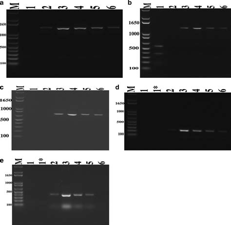 1 5 Agarose Gel Electrophoresis Analysis Of Sap Mediated RT And Or PCR