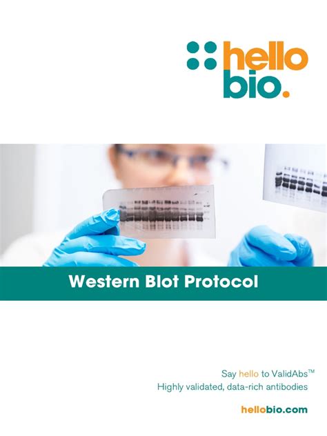 Western Blot Protocol | PDF | Western Blot | Gel Electrophoresis