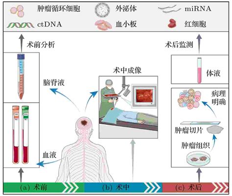 太赫兹技术在胶质瘤诊疗中的应用 从组织分级到分子分型