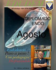 Diplomado Endodoncia Agosto Colegio De Cirujanos Dentistas De