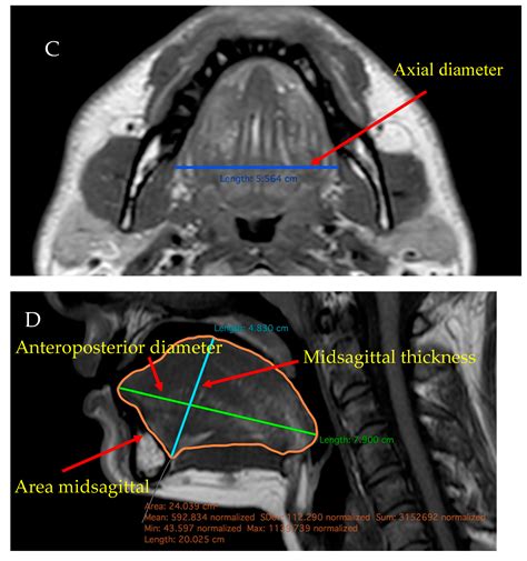 Applied Sciences Free Full Text Ultrasound And Magnetic Resonance