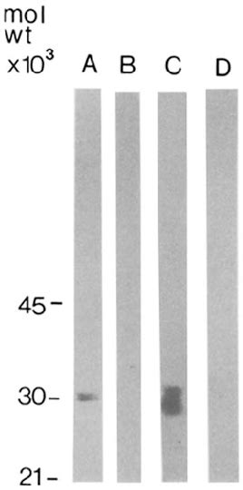 Immunoblotting Shows That The Igg From Patient Bi Has A Reactivity With