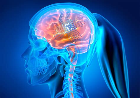 Tag Neuralink First Implant Patient Mind Matters