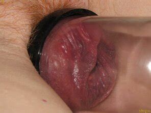 Susan Muhling Porn Pic