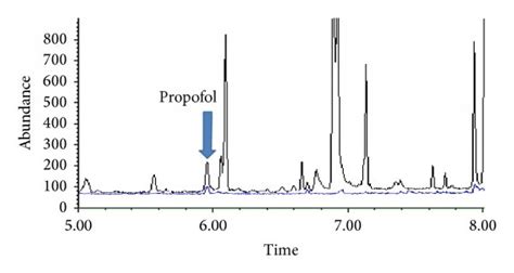 The Representative Extracted Ion Chromatograms Of Authentic Heart Download Scientific Diagram