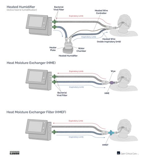 Ventilator circuit humidification types - Open Critical Care