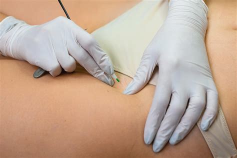 Achieve Smooth Confident Skin With Laser Hair Removal For Your Bikini Area