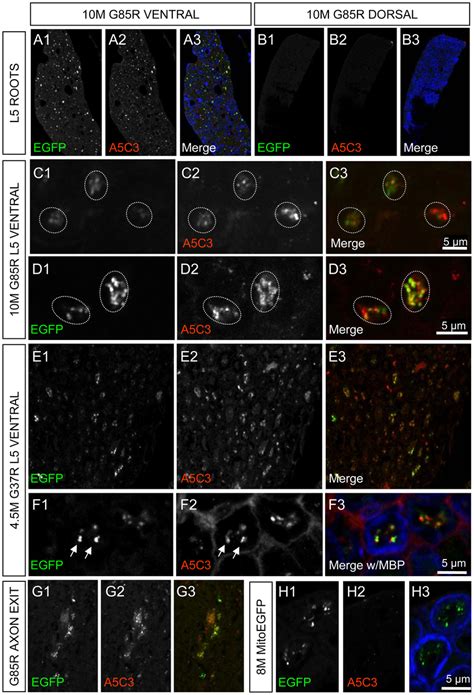 Misfolded Sod Associates With Motor Neuron Axonal Mitochondria In