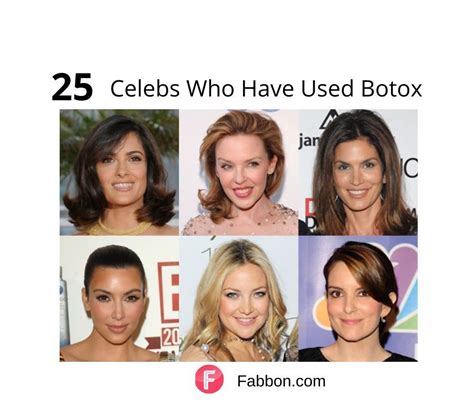 25 Top Celebrities Who Have Had Botox | Fabbon