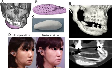 clinical application  ct bone case  excerpted  ref