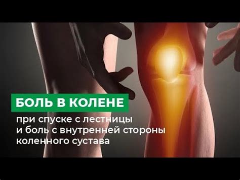 Боль в колене при спуске с лестницы и боль с внутренней стороны ...