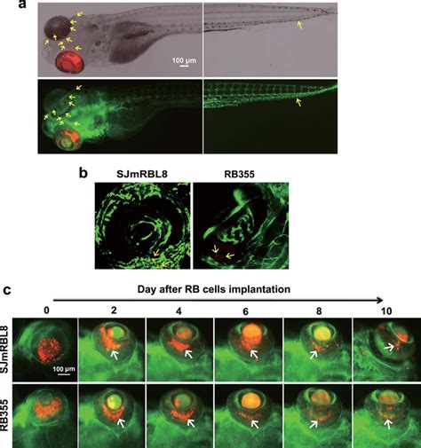 Interaction Between Retinoblastoma Cells And Vasculatures A A