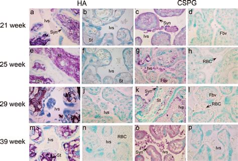 Histochemical And Immunohistochemical Analyses Of Ha And Cspg In Human