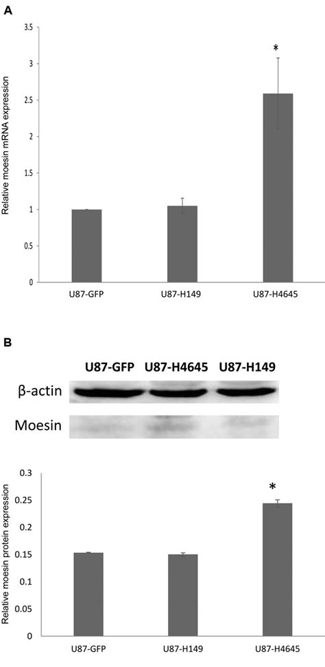 Moesin Up Regulation Is Associated With Enhanced Tumor Progression