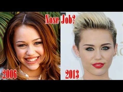 Pin By Hellen Rose On Celebs Random Pics Nose Job Plastic Surgery