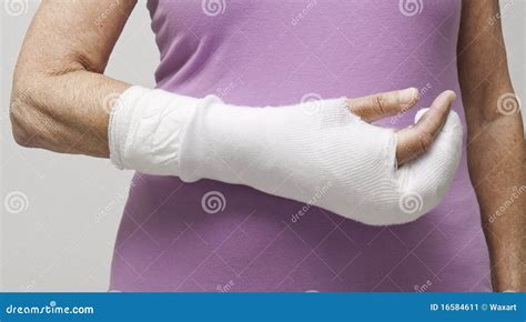 Woman's Hand In Bandage And Cast Stock Image - Image: 16584611