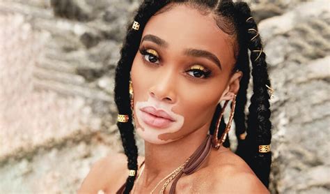 Winnie Harlow Net Worth, Biography, Net Worth, Career, Husband