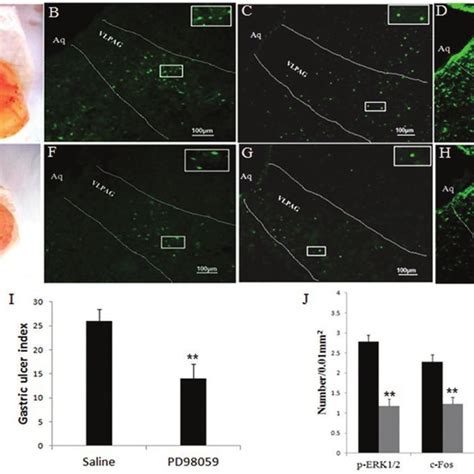 Effects Of Restraint Water Immersion Stress Rwis On Gastric Mucosal