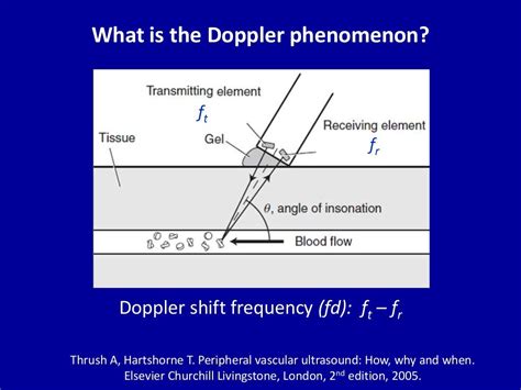 Principles Of Doppler Ultrasound