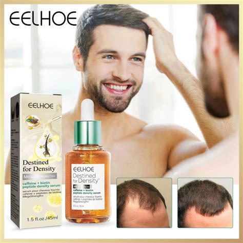 Eelhoe Biotin Fast Hair Growth Oil Hair Regrowth Serum Prevent Baldness