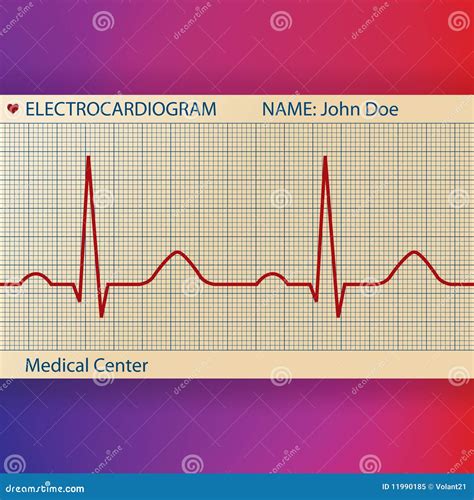 Papel Do Electrocardiograma ECG Normal Ilustração do Vetor