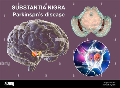 Substantia Nigra