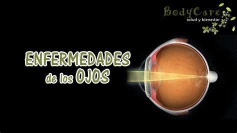 Enfermedades De Los Ojos Youtube