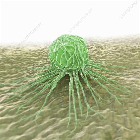 Breast Cancer Cell Artwork Stock Image C020 4833 Science Photo