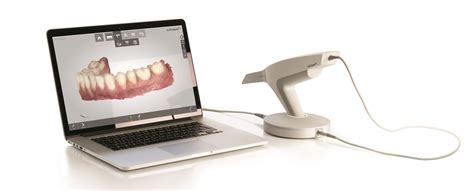 Our New Technology Trios 3shape Digital Scanner Mill Creek Dental