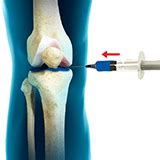 Especialistas Para Infiltración De Rodilla Doctor Especialistas