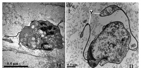 Transmission Electron Micrographs Of Myxospores Of Ceratomyxa