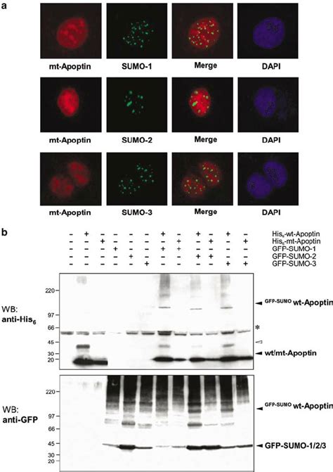 Mutation Of Apoptins LRS Abrogates Sumoylation A Mutant Apoptin