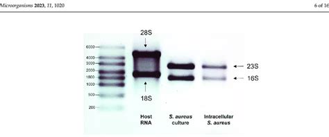 Exemplary image of gel electrophoresis of RNA isolated from endothelial ...