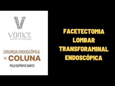 Facetectomia Lombar Transforaminal Endosc Pica Para Tratamento De