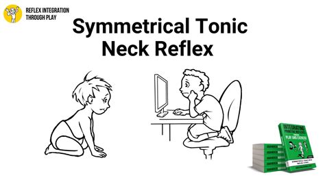 Benefits of the Symmetrical Tonic Neck Reflex (STNR) - Reflex ...