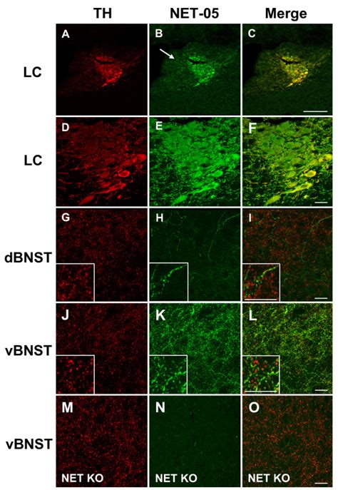 Net Colocalizes With Th In The Locus Ceruleus And Bed Nucleus Of The