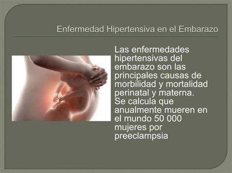 Enfermedades Hipertensivas Embarazo Ppt