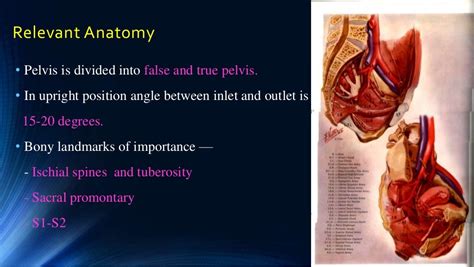 Vault Prolapse Pelvic Organ Prolapse Supports Of Uterus