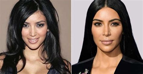 Decoding Kim Kardashian S Plastic Surgery Timeline Fact Vs Fiction