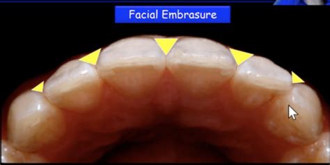 Midterm Vocabulary Review for English Course Flashcards | Quizlet