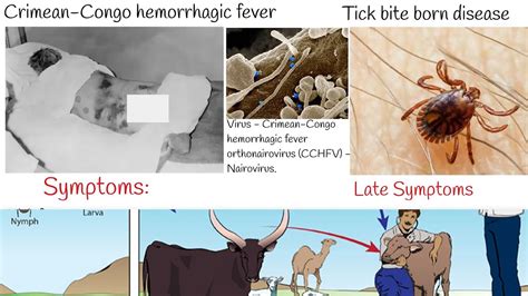 Hemorrhagic Fever Symptoms