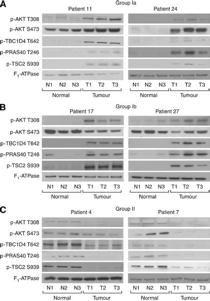 Examples Of Akt Thr308 And Ser473 Phosphorylation Together With The Download Scientific